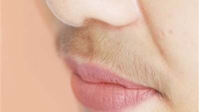 نمو شعر الذقن عند المرأة ينذر بمشكلة صحية