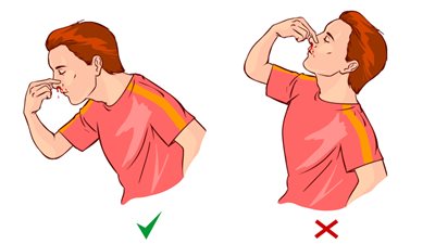 خطوات ضرورية للحماية من نزيف الأنف مع الموجة الحارة (انفوجراف)