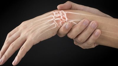 7 أعراض تؤكد إصابتك بنقص عنصر الكالسيوم