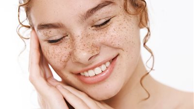 7 وصفات طبيعية من مطبخك للتخلص من النمش