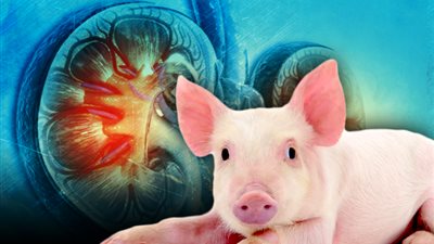 نجاح تجربة زراعة كلية خنزير في جسم شخص متوفى سريريا