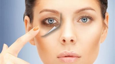 5 طرق للتخلص من الهالات السوداء أسفل العين