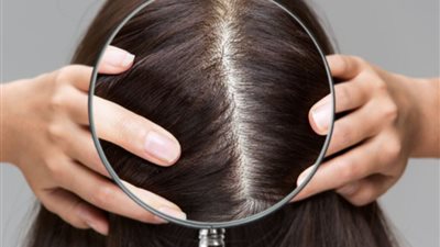 3 أسباب لرائحة فروة الرأس الكريهة وطرق العلاج 