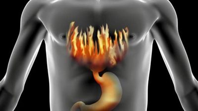 6 أنواع من الأطعمة تساعد على علاج حموضة المعدة في المنزل