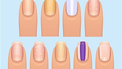 4 ألوان للأظافر تخبرك عن إصابتك بهذه الأمراض.. إحذري