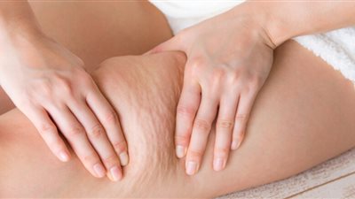 طرق طبيعية تخلصك من السيلوليت نهائيًا