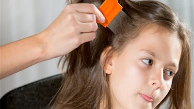 زيوت طبيعية لوقاية أطفالك من القمل مع بدء العام الدارسي 