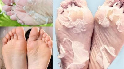 3 مقشرات منزلية لتنعيم القدمين وإزالة الخلايا الميتة