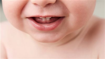 6 نصائح لمواجهة آلام التسنين المزعجة (إنفوجراف)