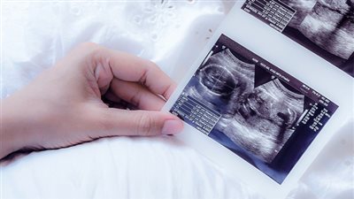 كيف تستخدمين الجدول الصيني لمعرفة نوع الجنين؟