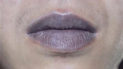 5 وصفات طبيعية تخلصك من الشفاة الداكنة