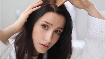 11 وصفة طبيعية لعلاج قشرة الشعر