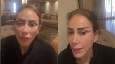 4 نجمات أصابتهن لعنة عمليات التجميل بعد ريهام سعيد