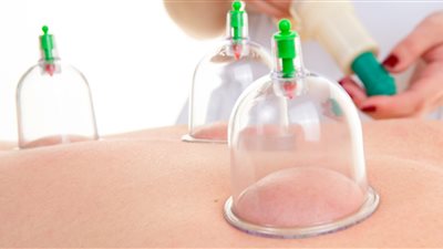 تفسير حلم الحجامة في المنام للعزباء والمتزوجة والحامل