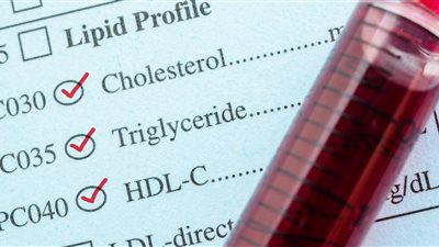 5 نصائح تجنبك مخاطر الإصابة بالدهون الثلاثية