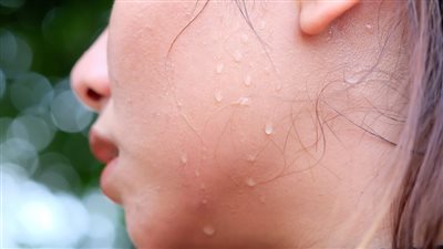 4 نصائح لا غنى عنها للعناية بالبشرة شديدة التعرق (إنفوجراف)