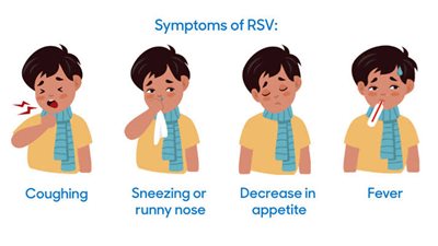 طرق جديدة لحماية الأطفال من فيروس RSV 