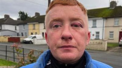 إيرلندي يأخذ جثة عمه لمكتب بريد للحصول على معاشه التقاعدي والشرطة تقبض عليه 