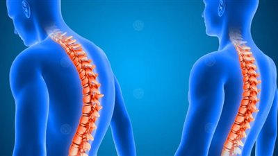 لآلام العمود الفقري | 5 تمارين تساعد على التعافي من تحدب الظهر