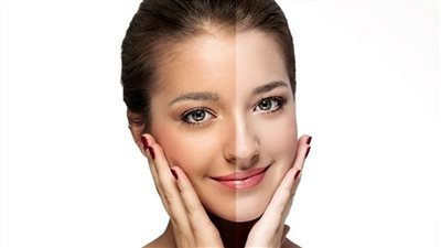 5 أطعمة تحميك من حروق الشمس والتصبغات الجلدية.. تناوليها في الصيف 